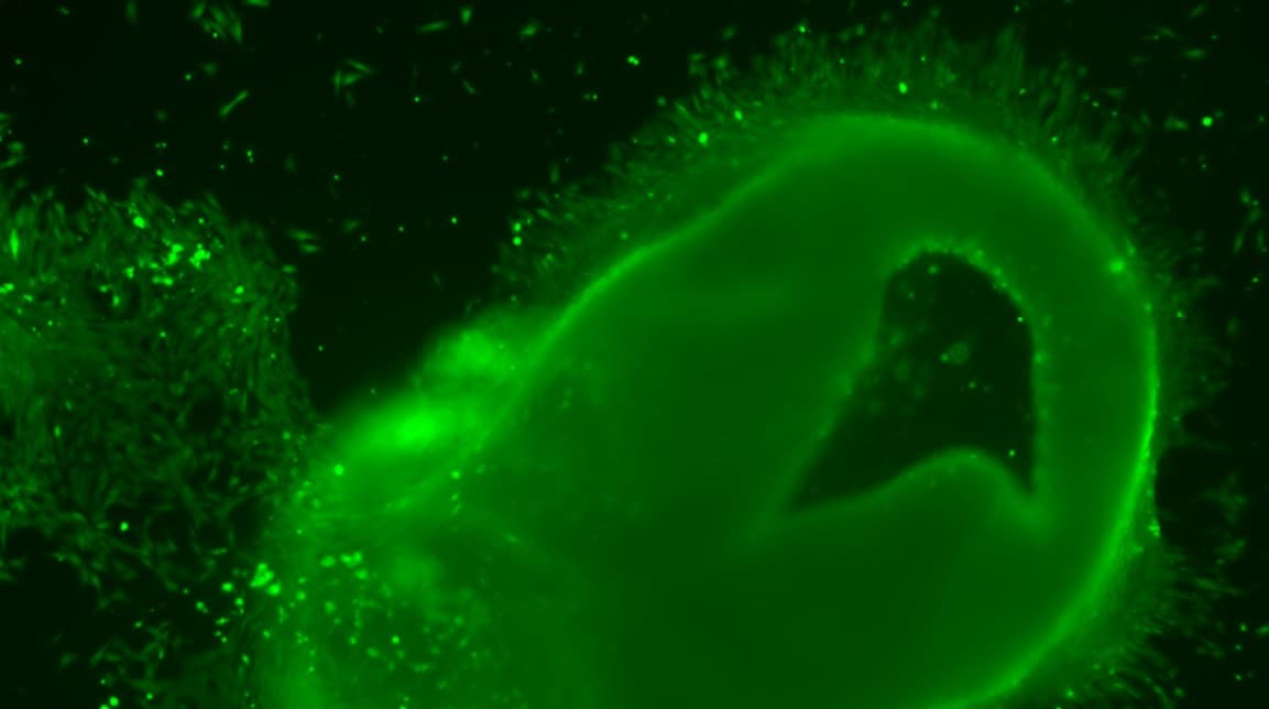 Nahaufnahme einer grünen, leuchtenden Struktur unter dem Mikroskop, die möglicherweise Zellen oder mikroskopische Organismen darstellt, mit Partikeln und weichen, unscharfen Rändern vor einem dunklen Hintergrund.