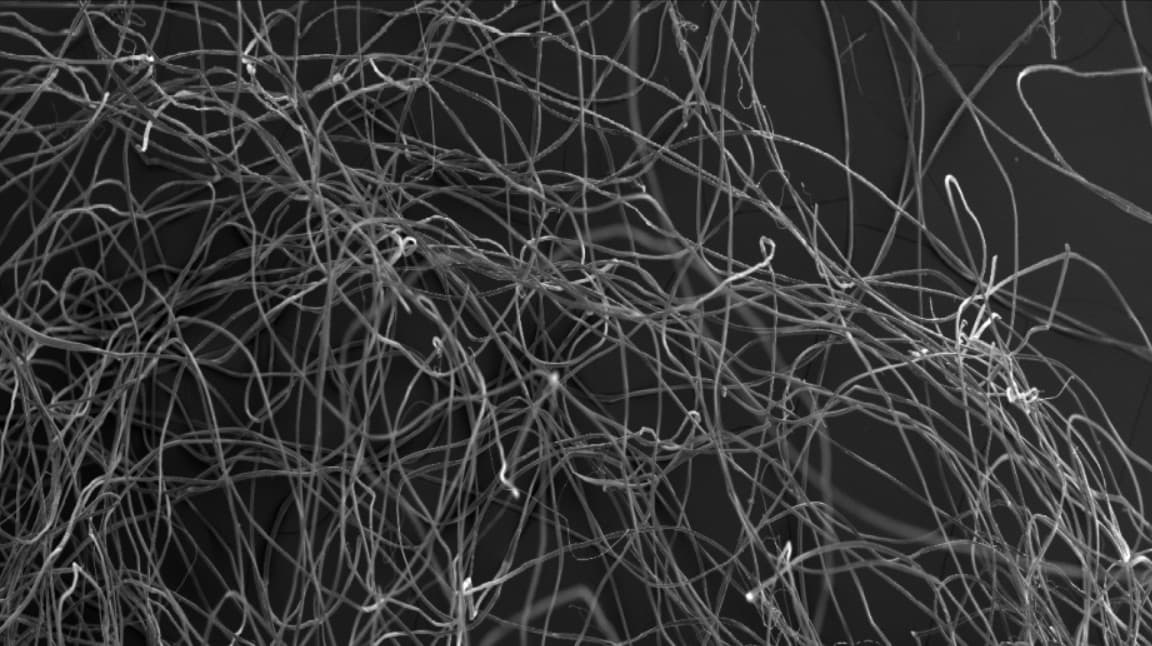 Ein Schwarzweißbild in Nahaufnahme, das ein verworrenes Netz aus dünnen, fadenförmigen Fasern oder Filamenten zeigt, die sich auf einem dunklen Hintergrund überlappen. Die Stränge variieren in ihrer Dicke und sind in verschiedene Richtungen gebogen.