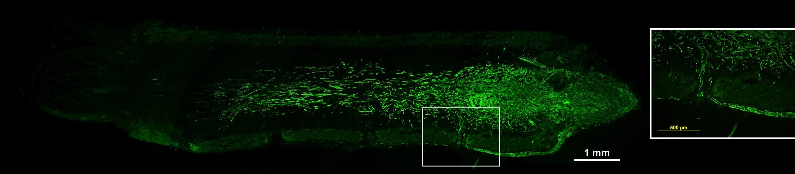 Fluoreszenzmikroskopische Aufnahme einer Gewebeprobe mit grün gefärbten Fasern; ein weißes Quadrat hebt eine bestimmte Region hervor, die in einem Ausschnitt unten rechts mit einem gelben 500-μm-Skalierungsbalken vergrößert dargestellt ist.
