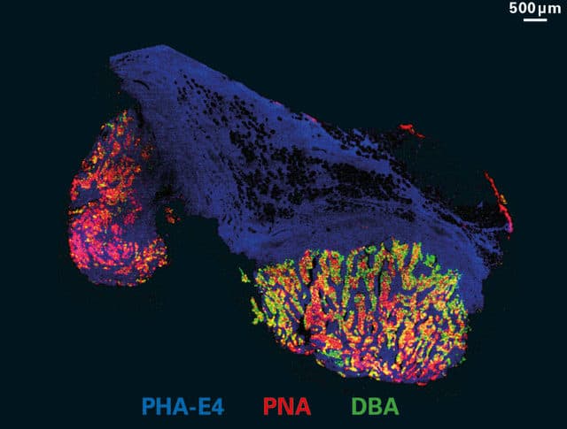 Fluoreszenzmikroskopische Aufnahme von Gewebeschnitten, die mit PHA-E4 in Blau, PNA in Rot und DBA in Grün markiert sind, mit einem Maßstab von 500 Mikrometern.
