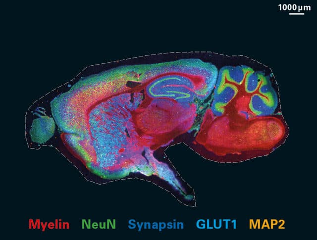 Ein sagittaler Schnitt durch ein Mäusegehirn mit Fluoreszenzmarkierung, einschließlich einer Legende zur Identifizierung der Marker Myelin, NeuN, Synapsin, GLUT1 und MAP2.