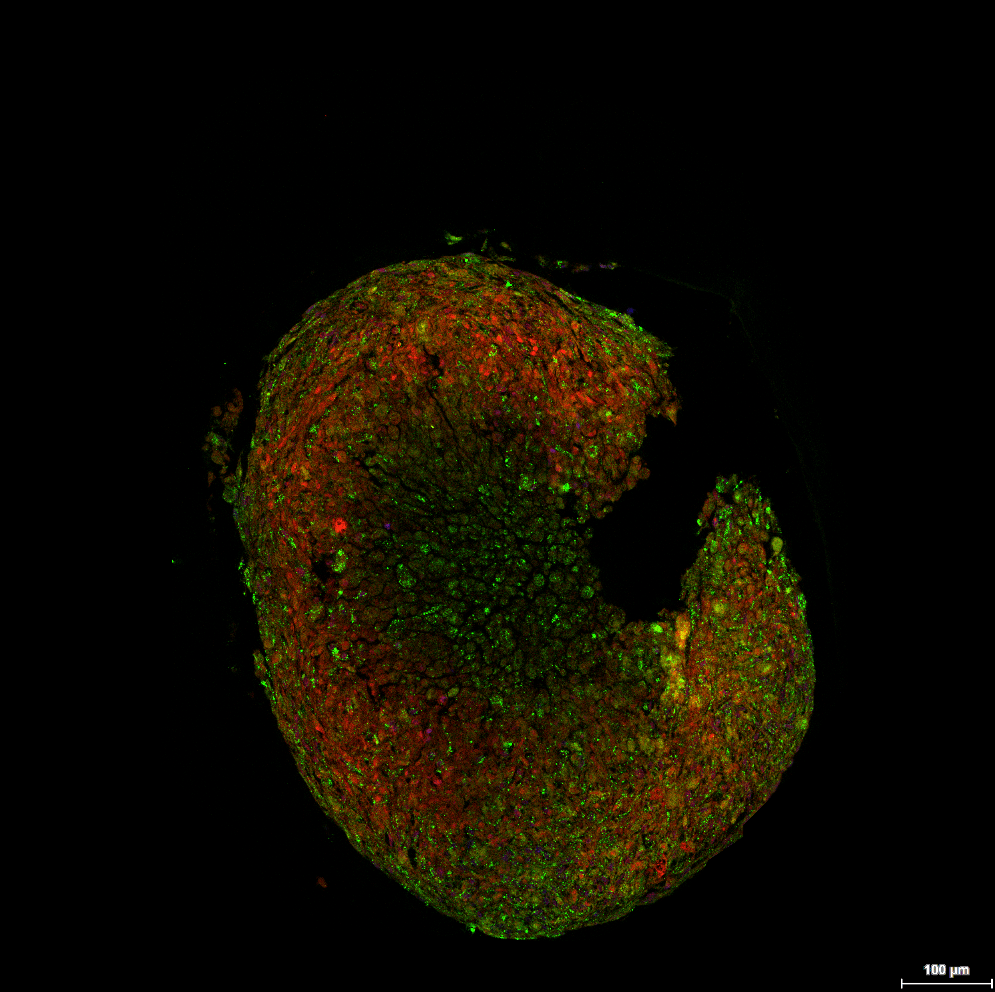 Fluoreszenzmikroskopische Aufnahme einer kreisförmigen Gewebeprobe mit einer Kerbe auf der rechten Seite, auf der grüne und rote Zellstrukturen zu erkennen sind.