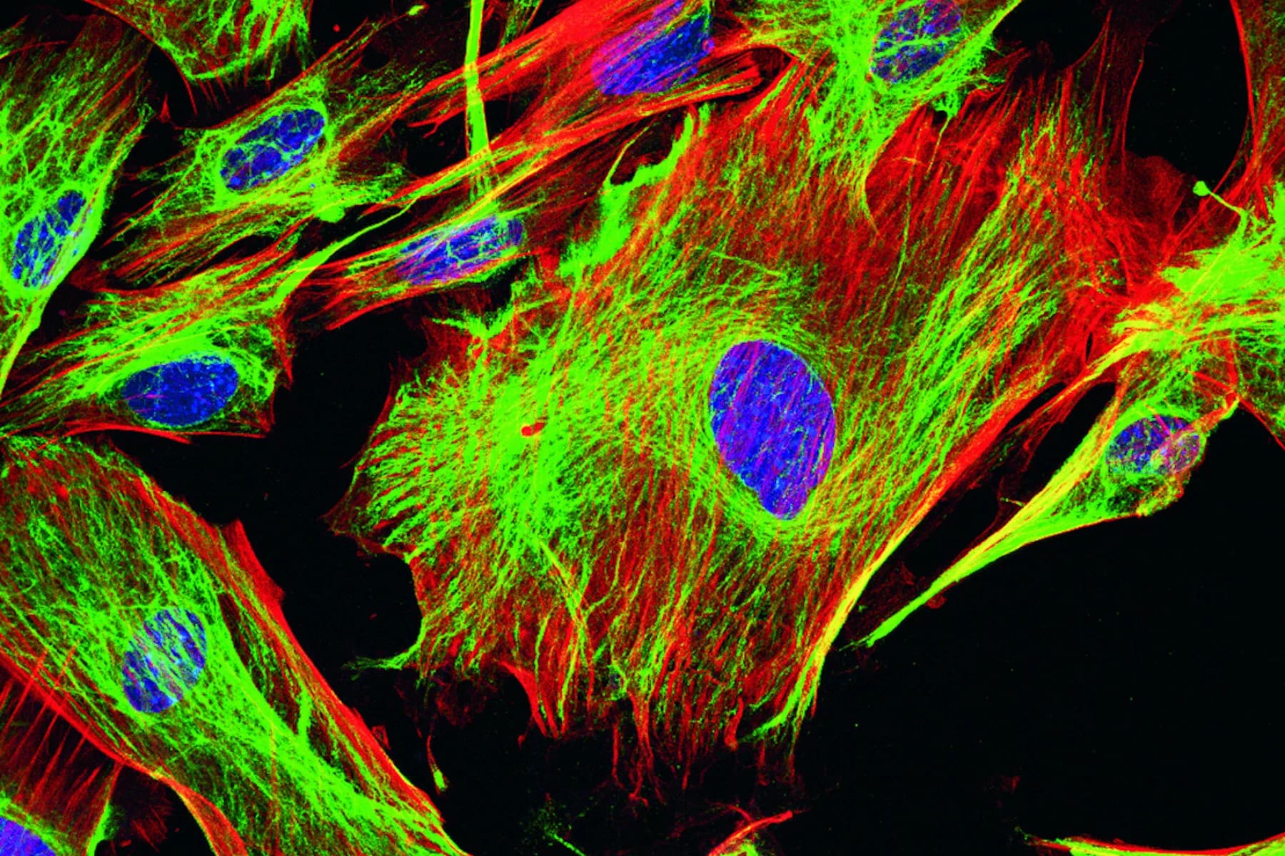 Fluoreszenzmikroskopie-Aufnahme, auf der Zellkerne blau, Aktinfilamente rot und Mikrotubuli grün dargestellt sind.