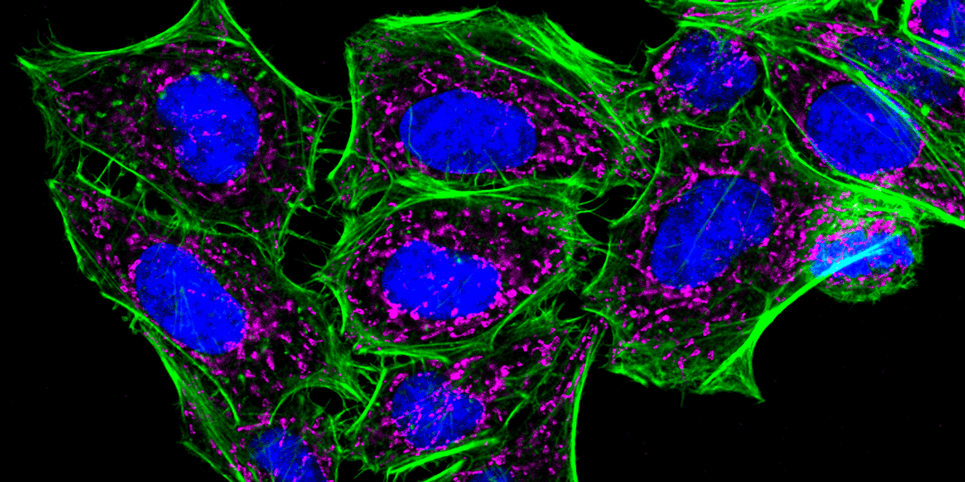 Mikroskopische Aufnahme von Zellen mit blauen Zellkernen, grünen Zytoskelettfilamenten und magentafarbenen Organellen vor schwarzem Hintergrund.