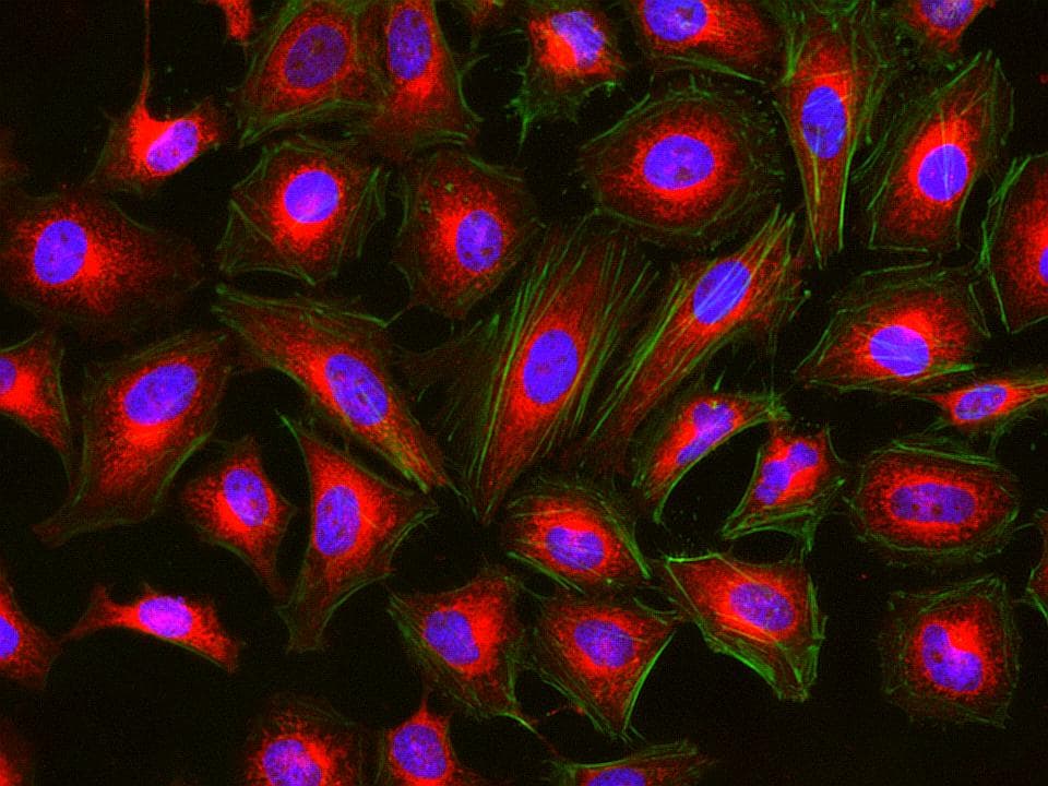 Fluoreszenzmikroskopische Aufnahme von Zellen, die blaue Zellkerne, rotes Zytoplasma und grüne Zytoskelettfilamente zeigt.