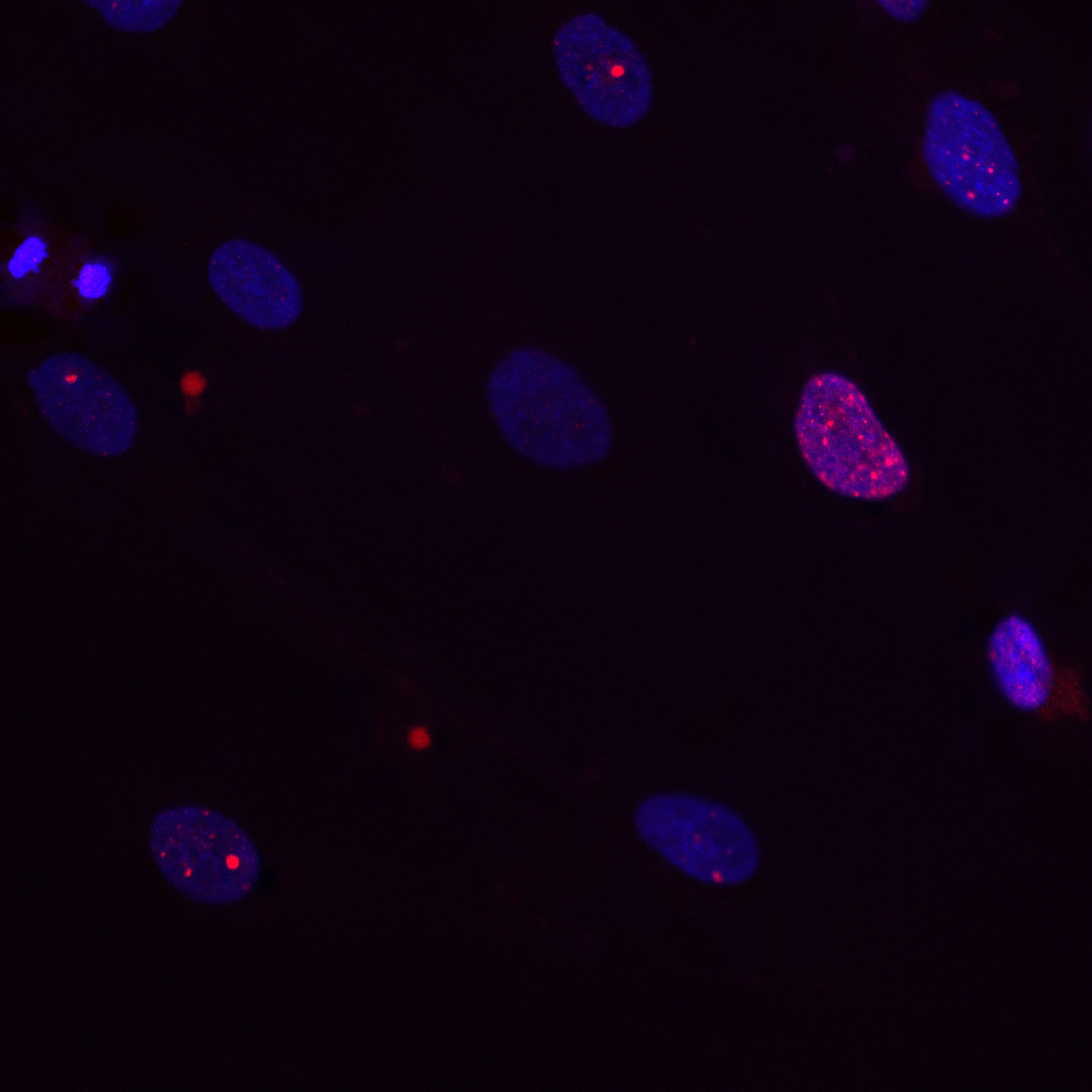 Fluoreszenzmikroskopie-Aufnahme, die blau angefärbte Zellkerne zeigt, wobei einige Kerne kleine rote Punktflecken aufweisen.