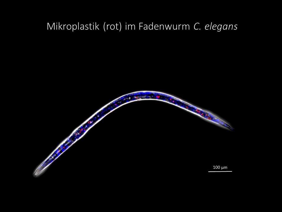 Mikroskopaufnahme von Wurm mit Mikroplpastik