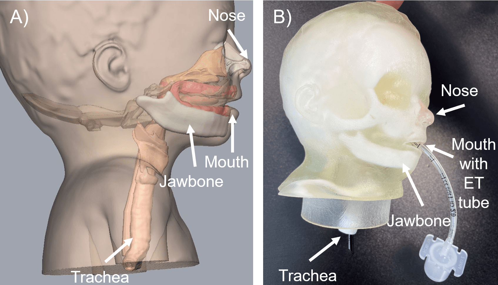 Seitenansichten im Vergleich: A) eine anatomische Abbildung des Kopfes und der Atemwege eines Kindes mit Beschriftung von Nase, Mund, Kieferknochen und Luftröhre; B) ein 3D-gedrucktes Modell eines Kinderkopfes mit einem Endotrachealtubus, das in gleicher Weise beschriftet ist.