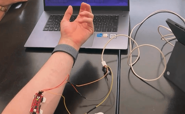 Der Unterarm einer Person, an dem elektronische Sensoren und Kabel angebracht sind, ist mit einer Leiterplatte verbunden, die wiederum mit einem Laptop auf einem Schreibtisch verbunden ist. Auf dem Bildschirm des Laptops ist eine überwiegend blaue Benutzeroberfläche zu sehen.